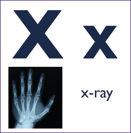 X